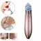 Chargeable Blackhead Removal Machine Black Head Remover Machine - Acne Pimple Pore Cleaner Vacuum Suction Tool Blackhead Removal On Nose Sucking Machine Blackheads Removal Device Derma Suction