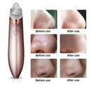 Chargeable Blackhead Removal Machine Black Head Remover Machine - Acne Pimple Pore Cleaner Vacuum Suction Tool Blackhead Removal On Nose Sucking Machine Blackheads Removal Device Derma Suction