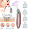 Chargeable Blackhead Removal Machine Black Head Remover Machine - Acne Pimple Pore Cleaner Vacuum Suction Tool Blackhead Removal On Nose Sucking Machine Blackheads Removal Device Derma Suction