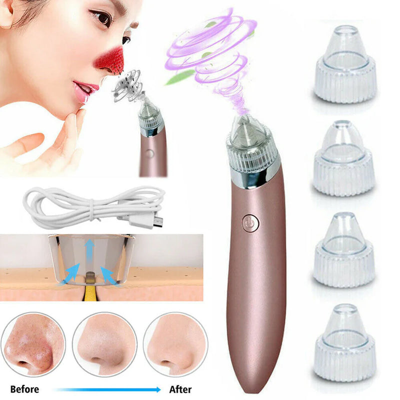 Chargeable Blackhead Removal Machine Black Head Remover Machine - Acne Pimple Pore Cleaner Vacuum Suction Tool Blackhead Removal On Nose Sucking Machine Blackheads Removal Device Derma Suction